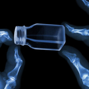 Surprise_salt_risk_weaker_bones-1338x460