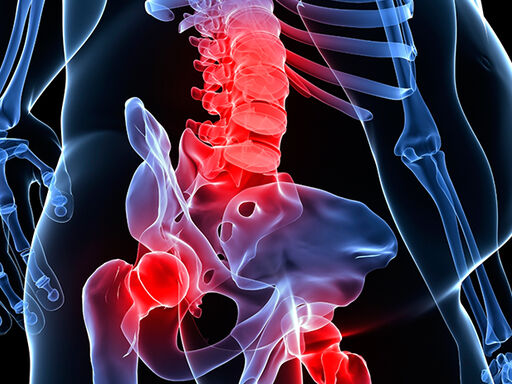 Bulge-Bad-for-Bones-4